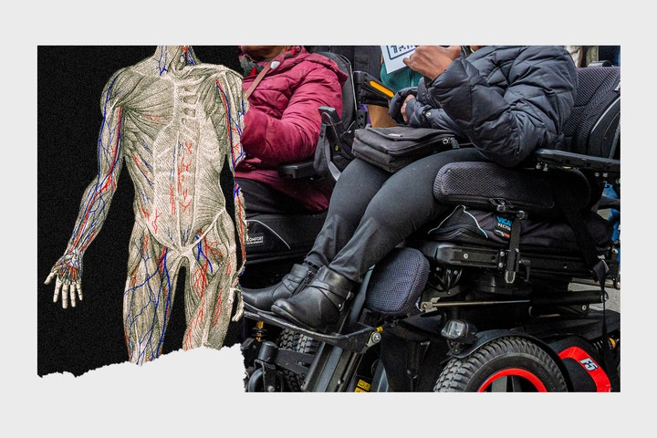Collage of images of human anatomical illustrations and person in wheelchair